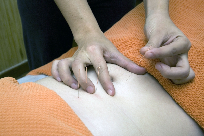 osteopathe-BLAUSASC-min_acupuncture-4175625